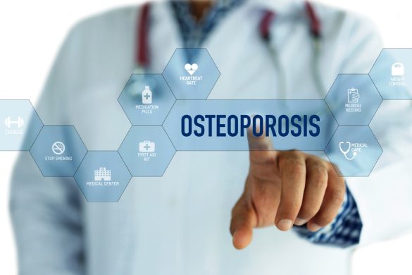 Osteoporosis